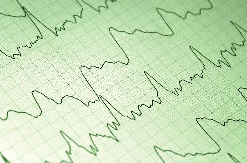 잠재력 - 이미지