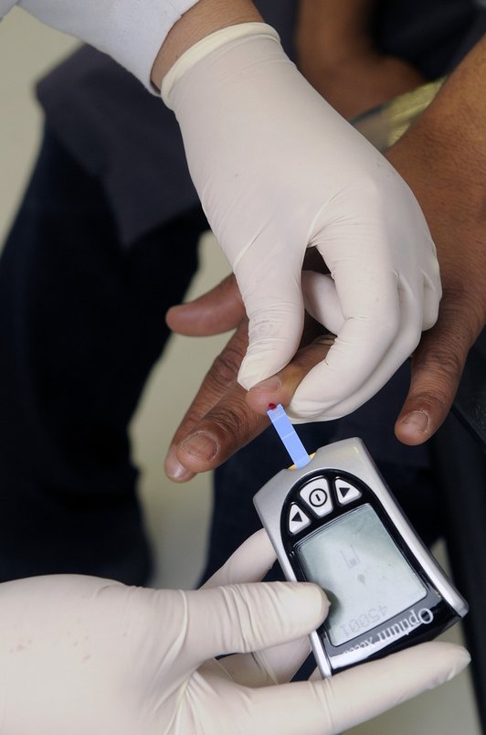 임상 시험 - 이미지